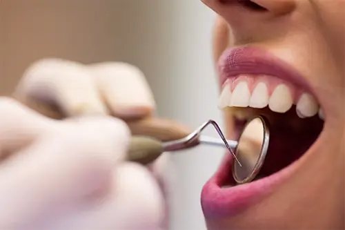 Exodoncias o extracciones dentales (sujeto a valoración)